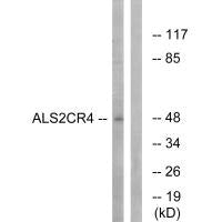 TMEM237 Antibody
