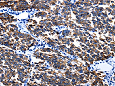 KRT6A Antibody