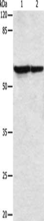 VIM Antibody