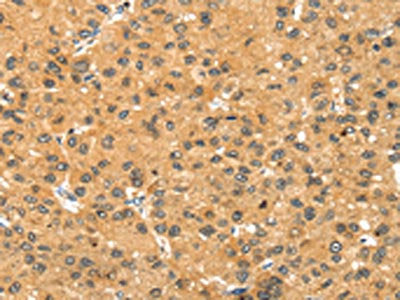 SMYD3 Antibody