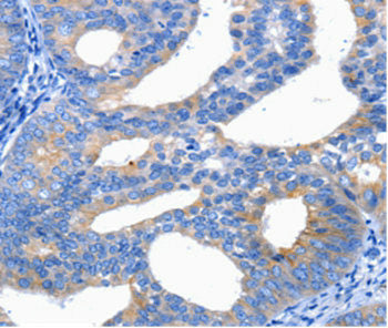 CTLA4 Antibody