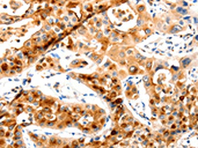 MAP2K2 Antibody
