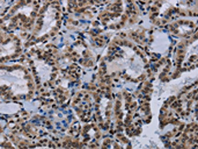 HMGB1 Antibody