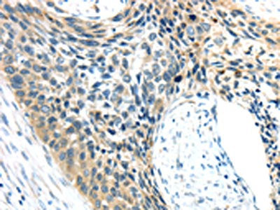 AEBP1 Antibody