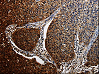 BID Antibody