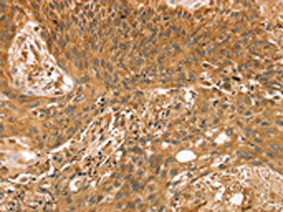 STX10 Antibody