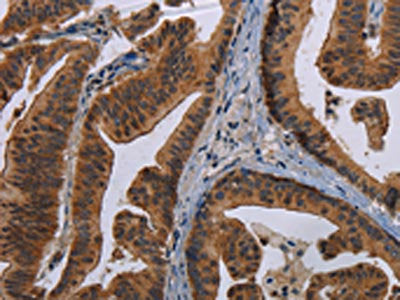 MAGEB3 Antibody