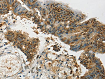 SYCP1 Antibody
