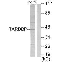 TBX1 Antibody