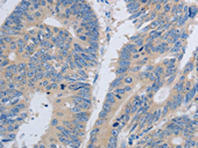 PAWR Antibody
