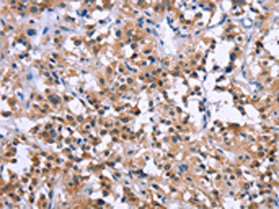 GNPAT Antibody