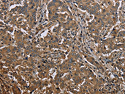 MCC Antibody