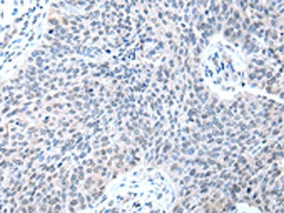 STRAP Antibody