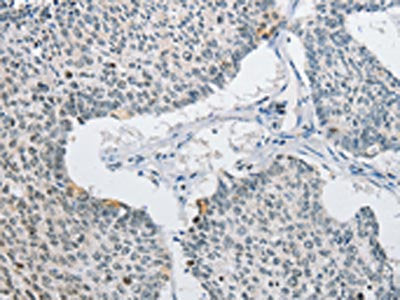 AP2M1 Antibody