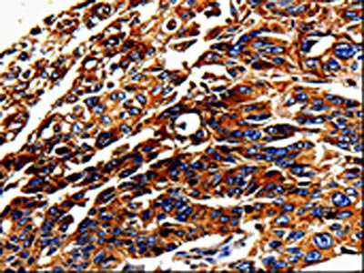 ALPL Antibody