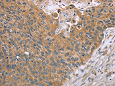 SAMD4B Antibody