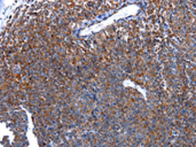 HSPD1 Antibody