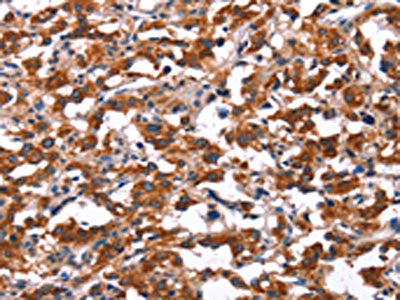 KCNJ9 Antibody