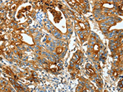 CEACAM5 Antibody