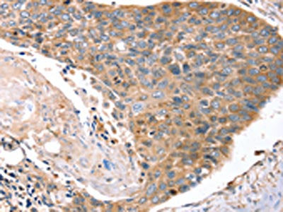 LAMP3 Antibody