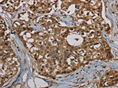 PNN Antibody