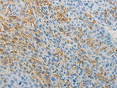 TNFRSF1B Antibody