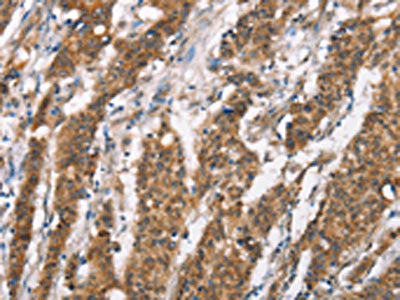 DSC2 Antibody