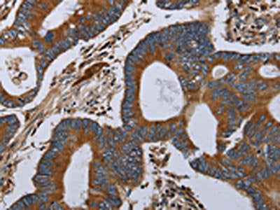 MT-ND6 Antibody