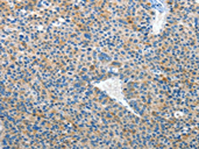 EPHB3 Antibody
