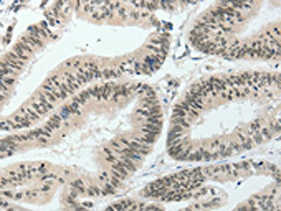 HNF1B Antibody