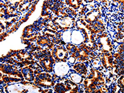 AFP Antibody