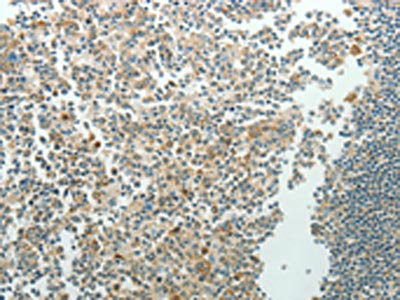 NDRG3 Antibody