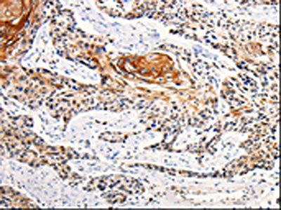 ANGPTL4 Antibody