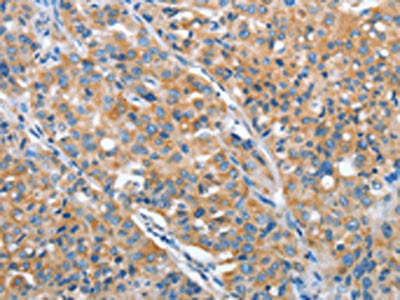 ARFGAP1 Antibody
