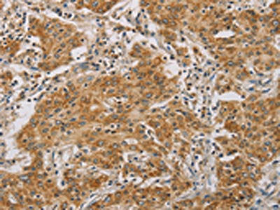 CDKN2A Antibody