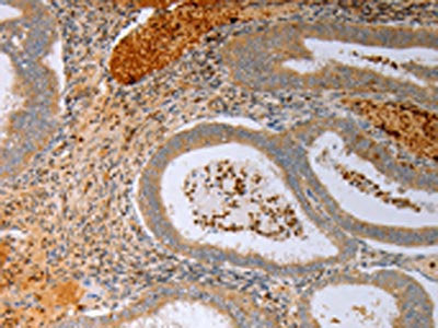 FOXN1 Antibody