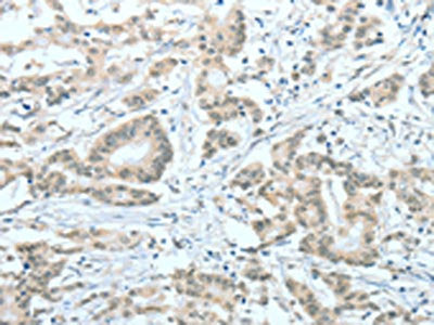 ASH2L Antibody