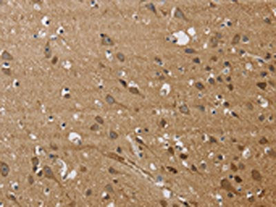 JAG1 Antibody
