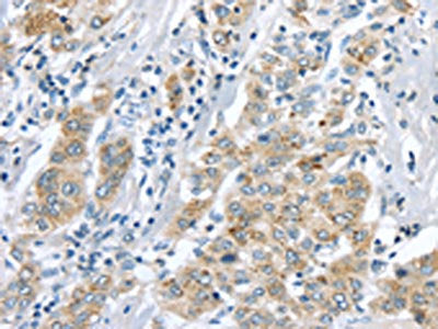 LRP6 Antibody