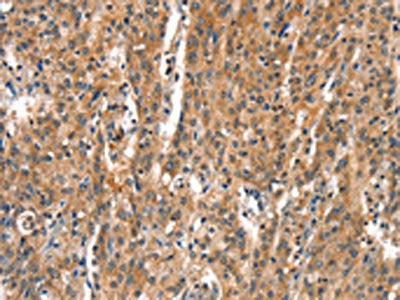DEAF1 Antibody