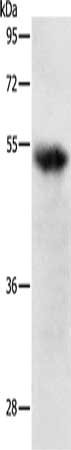 TNFRSF1B Antibody