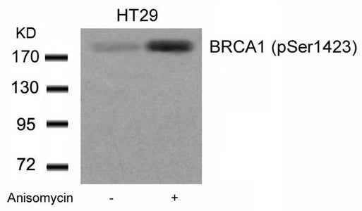 Phospho-BRCA1 (Ser1423) Antibody