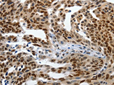 KLF5 Antibody