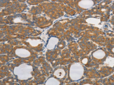 PPP2CB Antibody