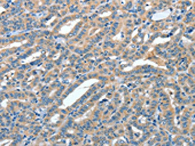 ANGPT1 Antibody