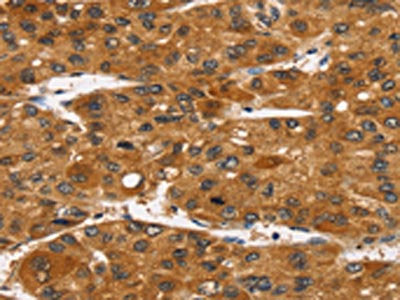 TACC2 Antibody