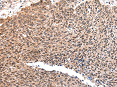 ATF1 Antibody