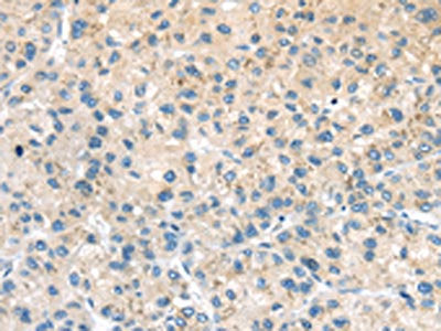 ADRB3 Antibody