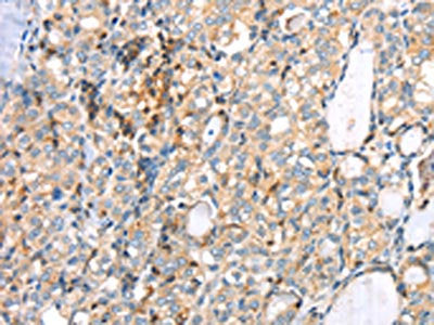 MAGEB2 Antibody