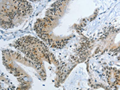 KDM1A Antibody